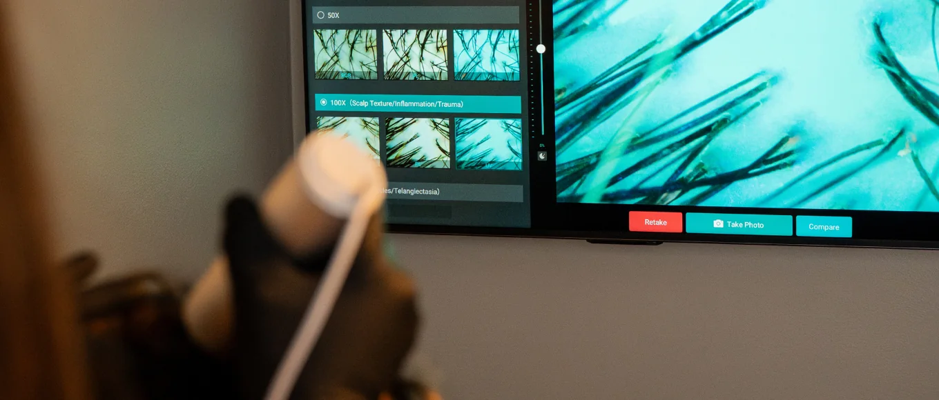 Close scalp assessment during a trichology consultation